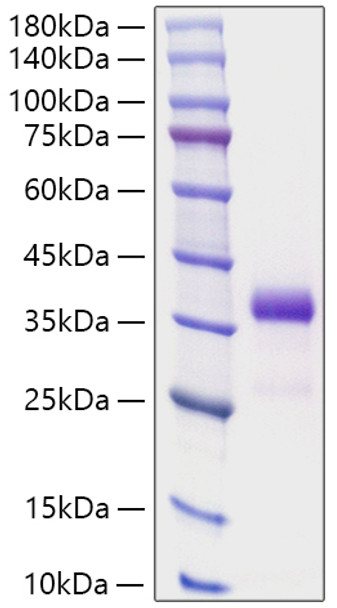 Recombinant Human IGFBP-7 Protein (RPCB1816)