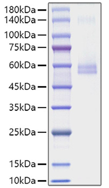 Recombinant Mouse TNFSF13/APRIL/CD256 Protein (RPCB1818)