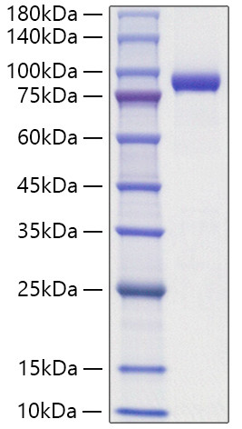 Recombinant Human IL1RAPL-2 Protein (RPCB1829)