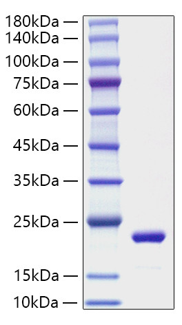 Recombinant Mouse IL-11 Protein (RPCB1854)