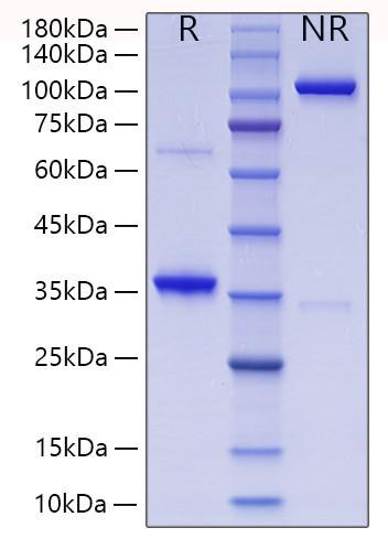 Recombinant Human Collagen II alpha 1/COL2A1 Protein (RPCB1861)