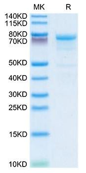Recombinant Human Plasma Kallikrein/KLKB1 Protein (RPCB1881)