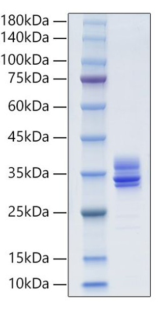 Recombinant Human MMP-7 Protein (RPCB1918)