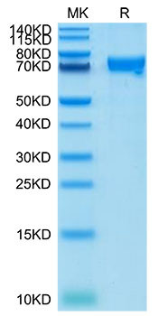Recombinant Cynomolgus CRTAM/CD355 Protein (RPCB1943)