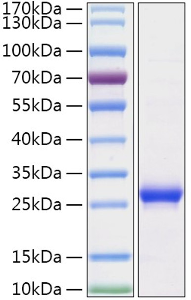 Recombinant Human Histone H1 Protein (RPCB1951)