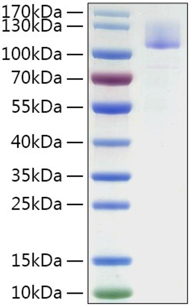 Recombinant Mouse Siglec-10 Protein (RPCB1961)