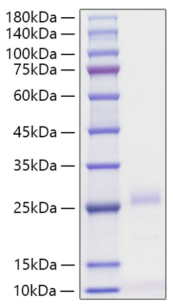 Recombinant Human IFN-beta Protein (RPCB1975)
