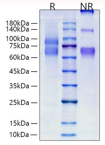 Recombinant Human Tenascin C/TNC Protein (RPCB1981)