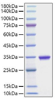 Recombinant Human IgG2A Protein (RPCB1988)
