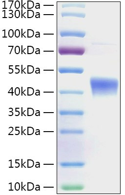 Recombinant Human MetAP1 Protein (RPCB2001)
