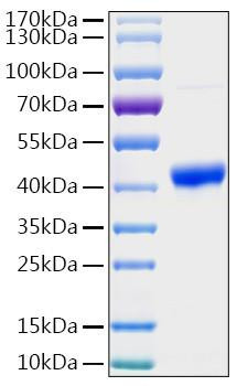 Recombinant Human PGK1 Protein (RPCB2016)