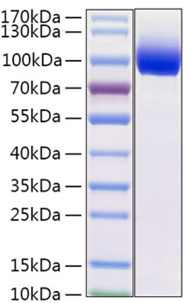 Recombinant Mouse IL-13RA1/CD213a1 Protein (RPCB2022)