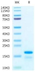 Recombinant Human Histone H2A Protein (RPCB2026)