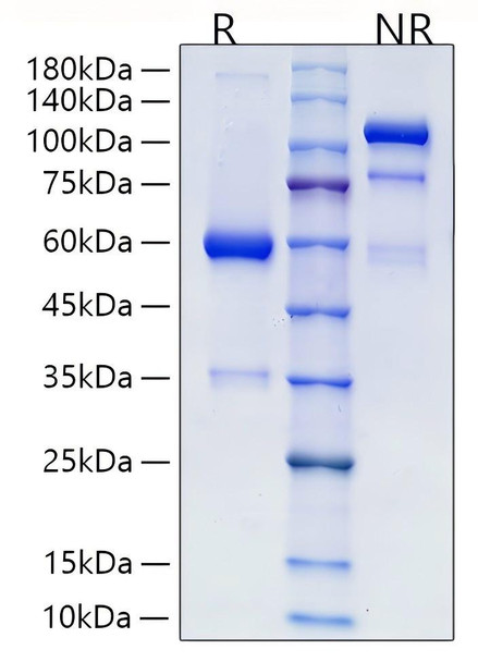 Recombinant Human R-spondin-2/RSPO2 Protein (RPCB2027)