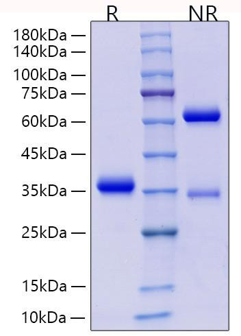 Recombinant Human IgG4 Protein (RPCB2073)