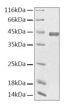 Recombinant Human Creatine Kinase MM/CKMM Protein (RPCB2115)