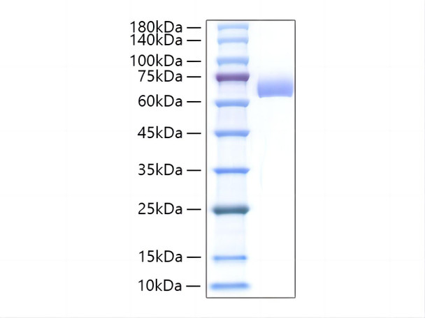 Recombinant Mouse Alkaline phosphatase (Intestinal type)/ALPI Protein (RPCB2118)