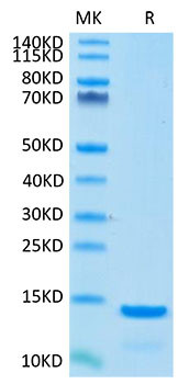 Recombinant Cynomolgus Beta-2-Microglobulin/B2M Protein (RPCB2170)