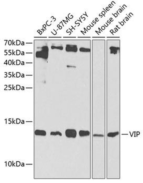 Anti-VIP Antibody (CAB1804)