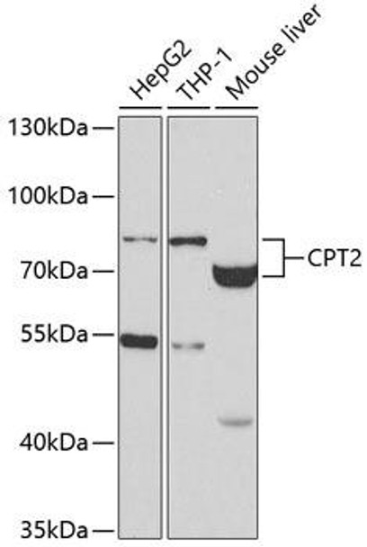 Anti-CPT2 Antibody (CAB2876)