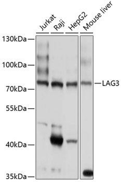 Anti-LAG3 Antibody (CAB2996)