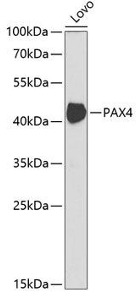 Anti-PAX4 Antibody (CAB5414)