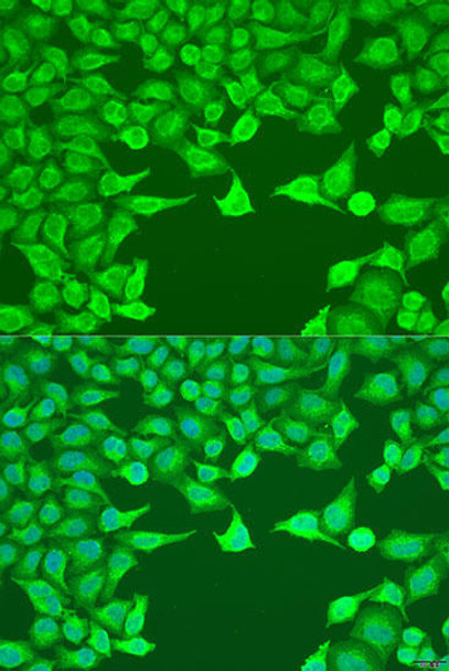 Anti-ATG9A Antibody (CAB5571)