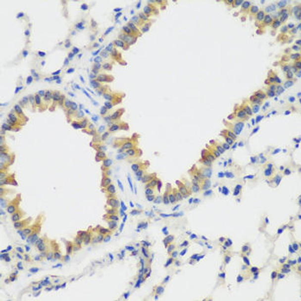 Anti-FLT4 Antibody (CAB5605)