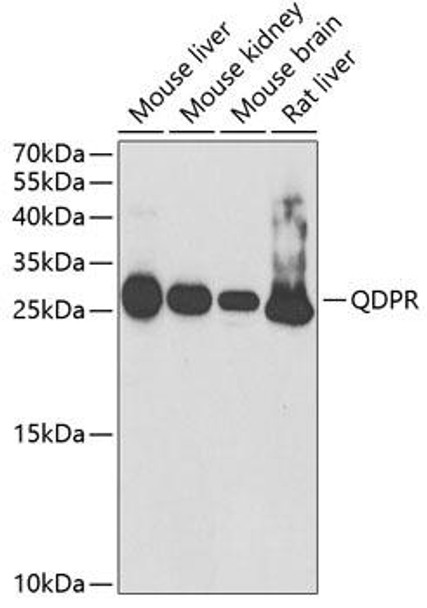 Anti-QDPR Antibody (CAB5733)