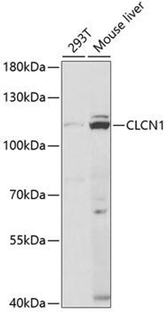 Anti-CLCN1 Antibody (CAB5739)