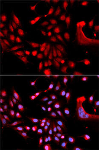 Anti-U2AF1 Antibody (CAB6076)