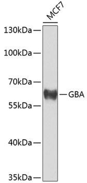 Anti-Glucosylceramidase Antibody (CAB8420)