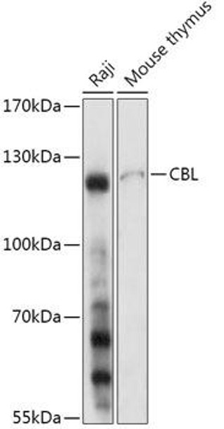 Anti-CBL Antibody (CAB17300)