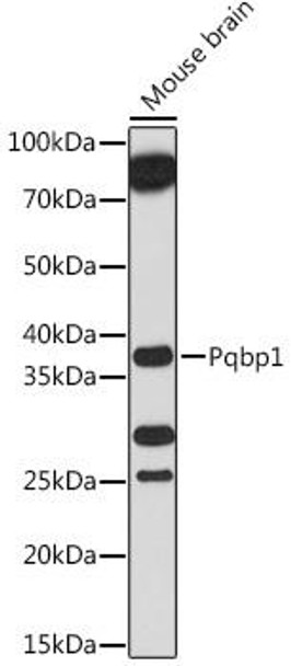 Anti-Pqbp1 Antibody (CAB18680)