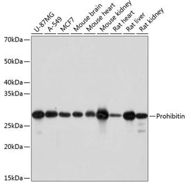 Anti-Prohibitin Antibody (CAB19530)