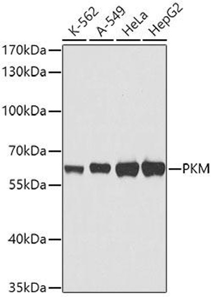 Anti-PKM Mouse Monoclonal Antibody (CAB0540)