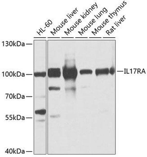 Anti-IL-17RA Antibody (CAB10052)