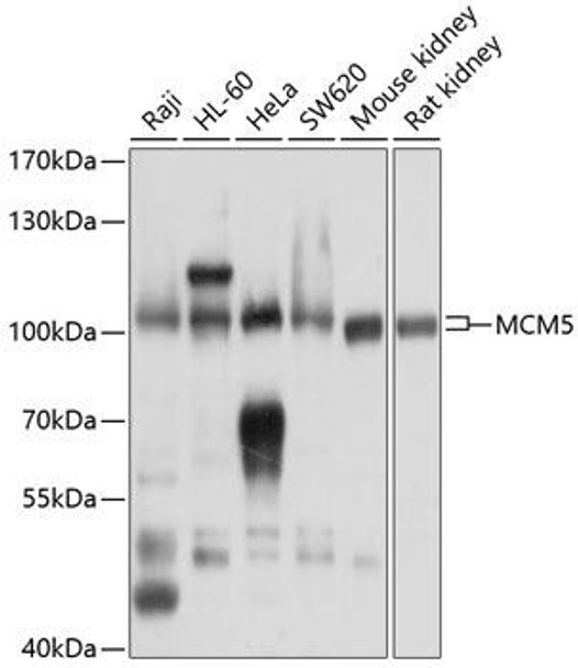 Anti-MCM5 Antibody (CAB13514)