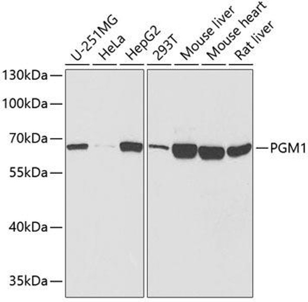 Anti-PGM1 Antibody (CAB13679)