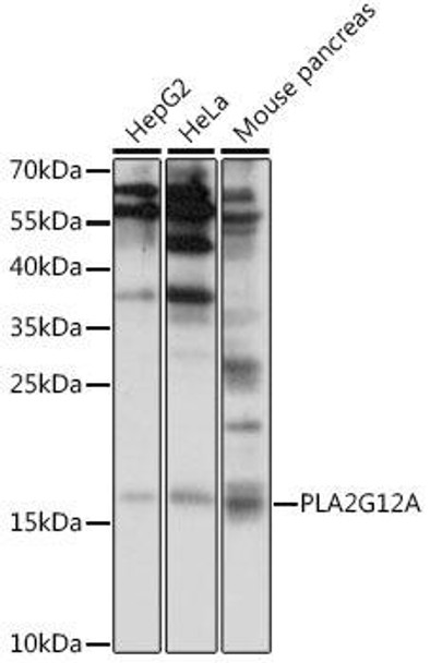 Anti-PLA2G12A Antibody (CAB15902)