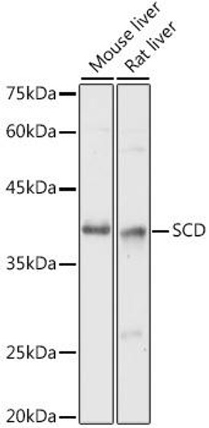 Anti-SCD Antibody (CAB16429)[KO Validated]