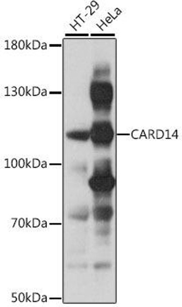 Anti-CARD14 Antibody (CAB16569)