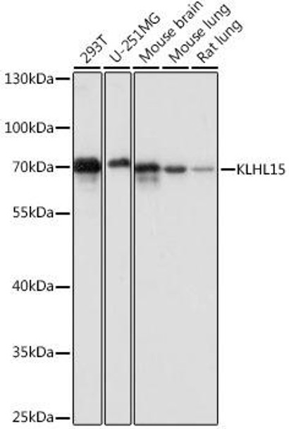 Anti-KLHL15 Antibody (CAB16574)