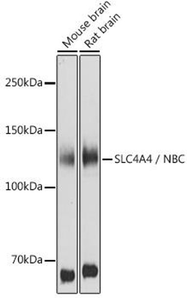 Anti-SLC4A4 / NBC Antibody (CAB5332)