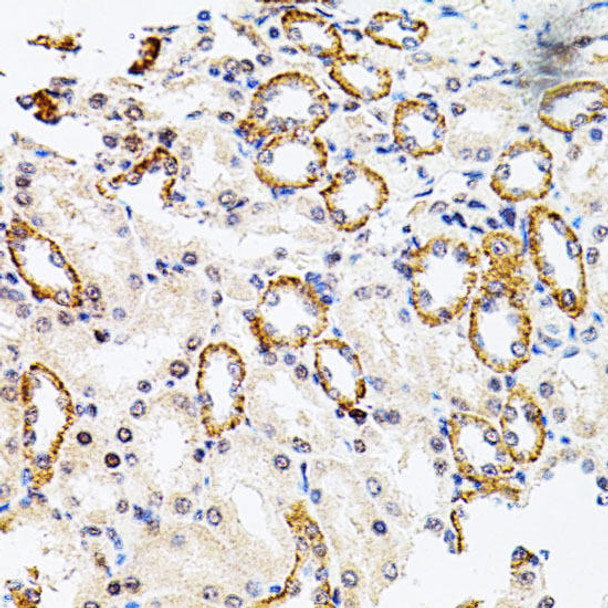 Anti-RPS6KA3 Antibody (CAB5436)