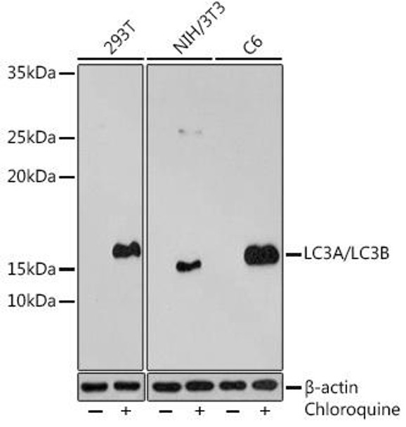 Anti-LC3A/LC3B Antibody (CAB5618)