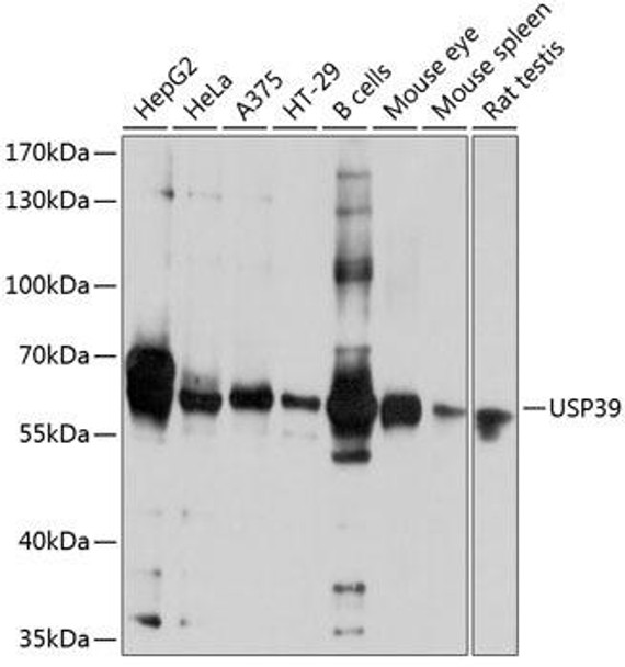 Anti-USP39 Antibody (CAB9582)