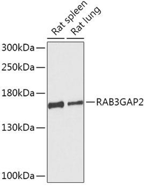 Anti-RAB3GAP2 Antibody (CAB17669)