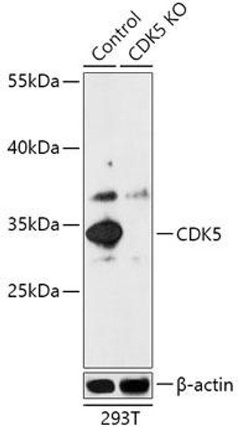 Anti-CDK5 Antibody (CAB18080)[KO Validated]
