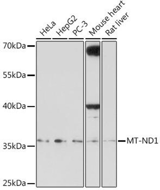 Anti-MT-ND1 Antibody (CAB18316)